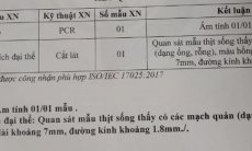 GoGi House khẳng định không có sán trong thịt