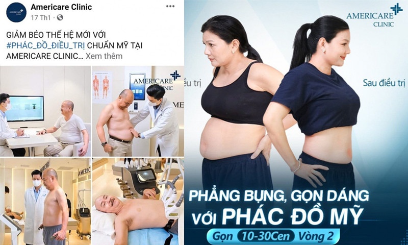 Nhiều nghệ sĩ nổi tiếng tham gia đóng quảng cáo về công nghệ giảm béo 